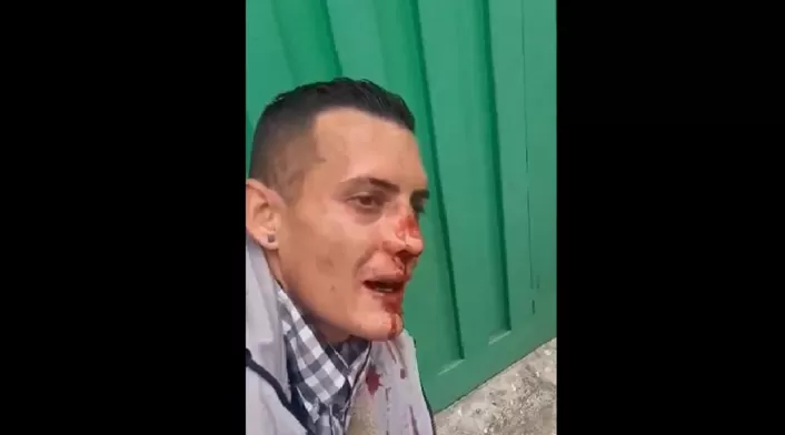 Le rompieron la nariz a ladrón de Fontibón Le rompieron la nariz a ladrón de Fontibón