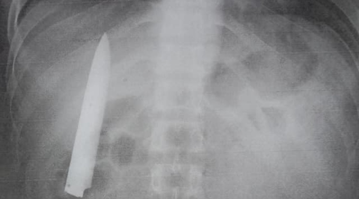 Hoja de cuchillo en un cuerpo