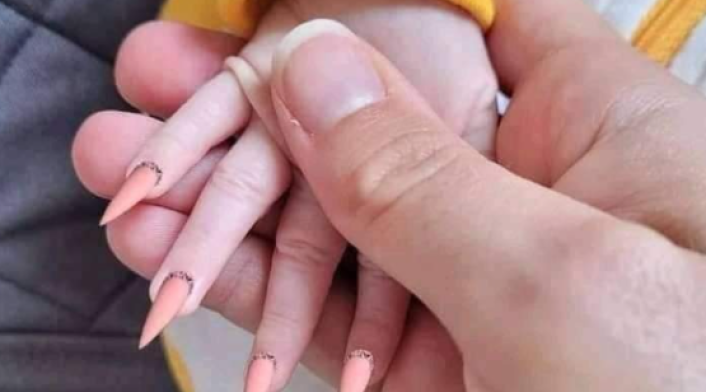 Uñas postizas en una bebé