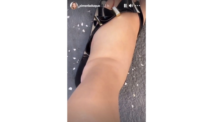Ximena Duque y las secuelas del embarazo