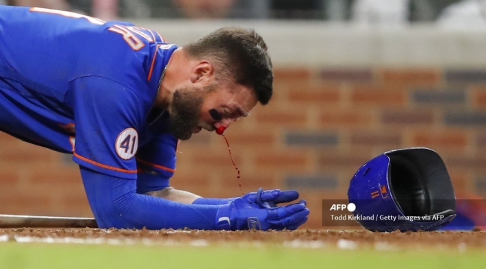 Kevin Pillar, beisbolista golpeado con la bola