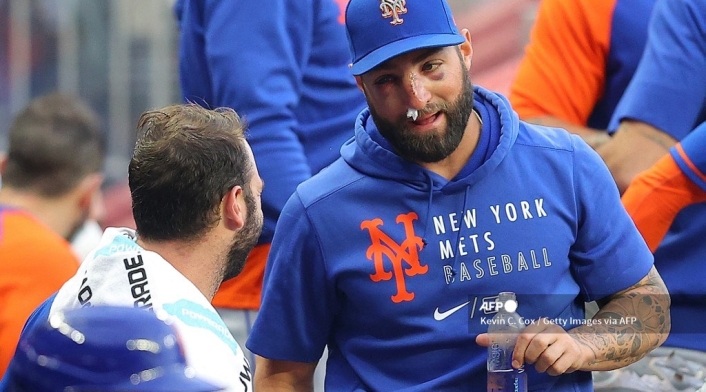 Kevin Pillar, beisbolista golpeado con la bola