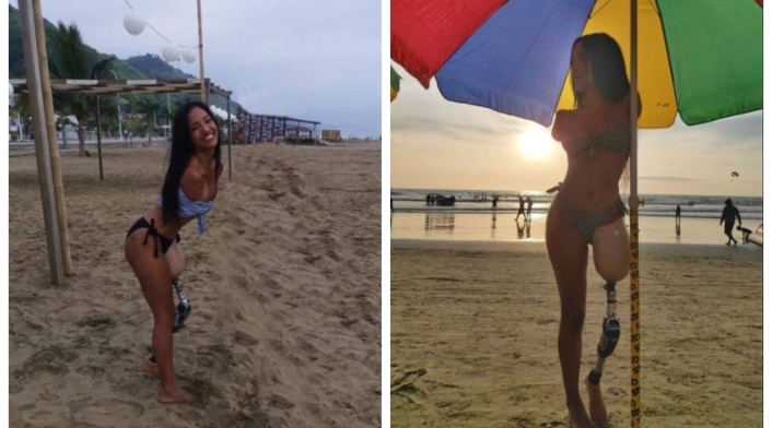 Victoria Salcedo, la modelo sin brazos ni una pierna