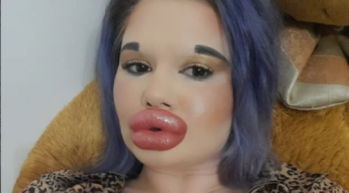 Andrea Emilova, mujer con los labios más grandes del mundo Andrea Emilova, mujer con los labios más grandes del mundo