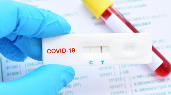 Pruebas caseras de Covid 19