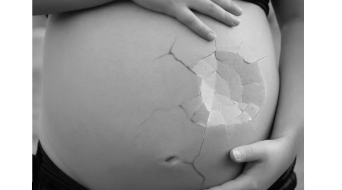 Aborto en Colombia: Proceso a seguir si un médico lo niega Aborto en Colombia: Proceso a seguir si un médico lo niega