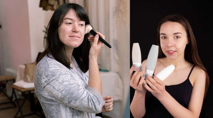 Uso de maquillaje y el acné Uso de maquillaje y el acné