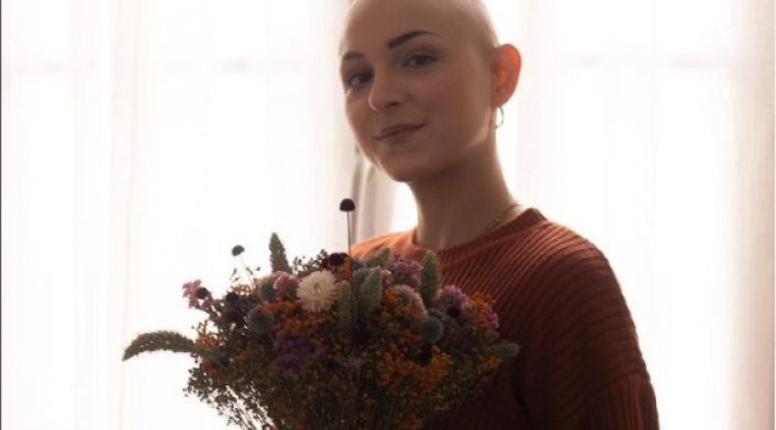 Elodicia, joven con alopecia Elodicia, joven con alopecia
