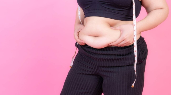 Mujer con obesidad mórbida Mujer con obesidad mórbida