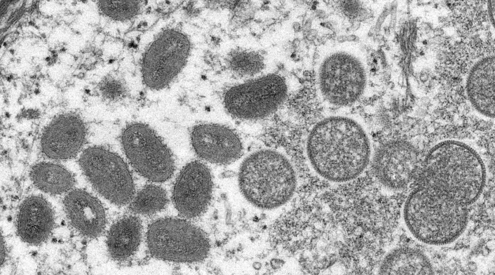 Virus de la viruela del mono