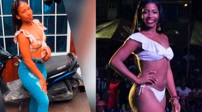 Yuliana Estacio, reina quemada por su pareja en Nariño Yuliana Estacio, reina quemada por su pareja