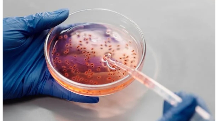 Las bacterias son la segunda causa de muerte a nivel mundial