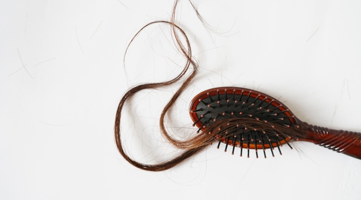 Implantes capilares, ¿cuánto cuestan? Implantes capilares, ¿cuánto cuestan?