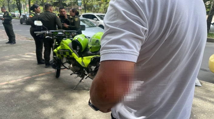 ¡Qué tal esto! Excandidato al Concejo, Javier Amaya, le disparó con arma traumática a un taxista