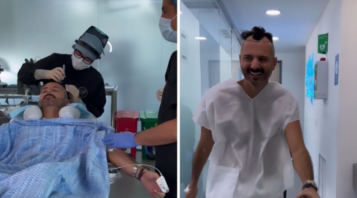 Mario Espitia compartió su cambio con sus seguidores Mario Espitia se hizo un implante capilar