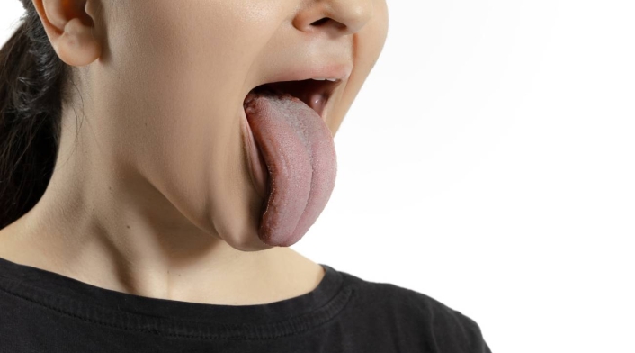 Limpiador de lengua Limpiador de lengua
