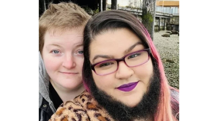 Mujer deja de afeitarse, le sale tupida barba y dice sentirse hermosa Mujer deja de afeitarse, le sale tupida barba y dice sentirse hermosa