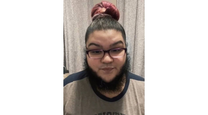 Mujer deja de afeitarse, le sale tupida barba y dice sentirse hermosa Mujer deja de afeitarse, le sale tupida barba y dice sentirse hermosa