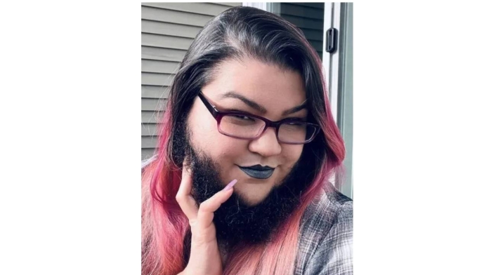 Mujer deja de afeitarse, le sale tupida barba y dice sentirse hermosa Mujer deja de afeitarse, le sale tupida barba y dice sentirse hermosa