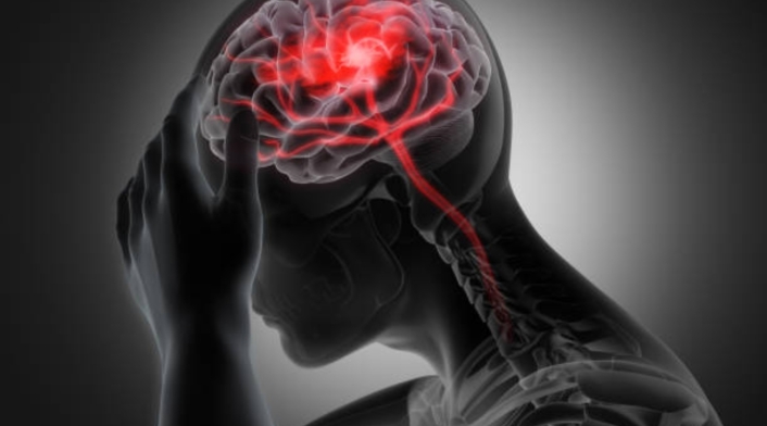 ¿Por qué sufro de migraña? ¿Por qué sufro de migraña?