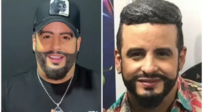 Nelson Velásquez con su barba y cabello que parecen falsos Nelson Velásquez con su barba y cabello que parecen falsos
