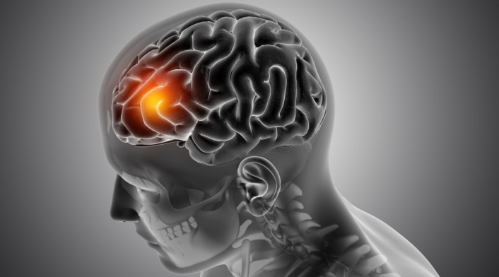 Daño cerebral, tumores, dolor de cabeza
