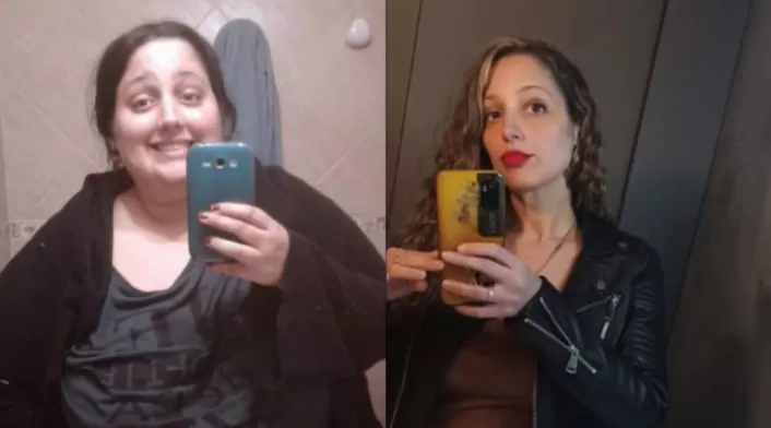 Mujer perdió 100 kilos Mujer perdió 100 kilos