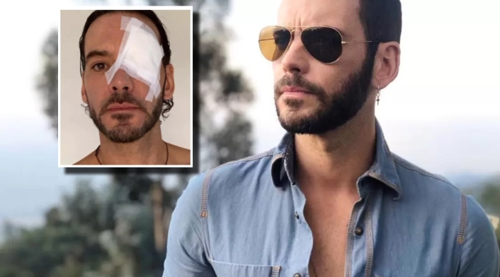 Diego Cadavid tuvo fuerte accidente y se “rompió la cabeza" Diego Cadavid tuvo fuerte accidente y se “rompió la cabeza"