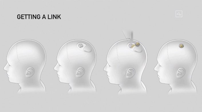 neuralink neuralink