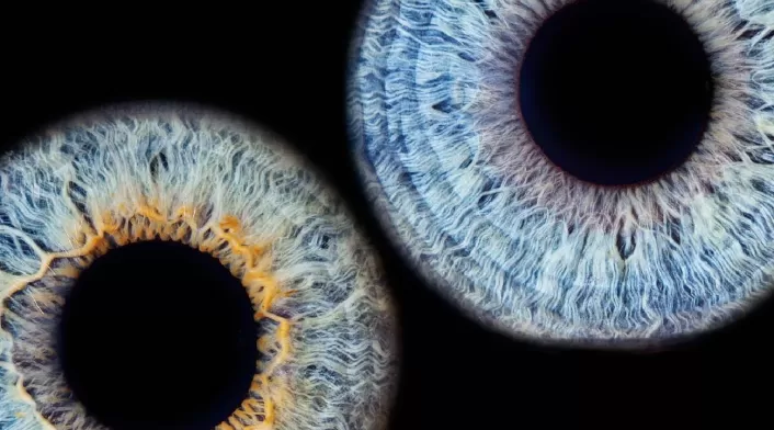 Iris de ojos: Obra de arte en Bogotá Iris de ojos: Obra de arte en Bogotá