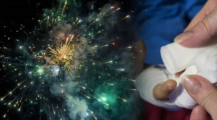 Aumenta cifra de quemados con pólvora Aumenta cifra de quemados con pólvora