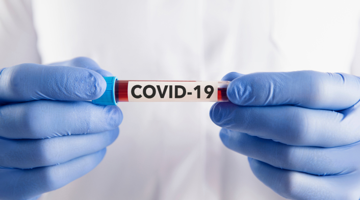 La CIA cambia su postura sobre el origen del covid19 La CIA cambia su postura sobre el origen del covid19
