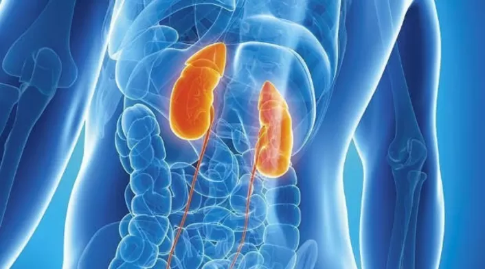 Cáncer de riñón Cáncer de riñón