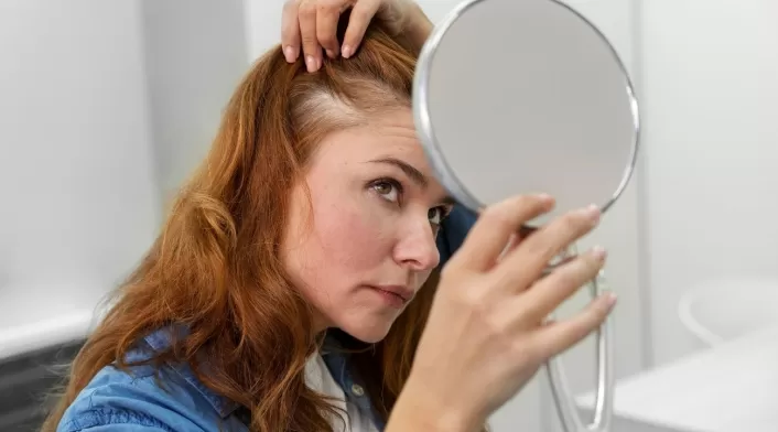 caída de cabello caída de cabello