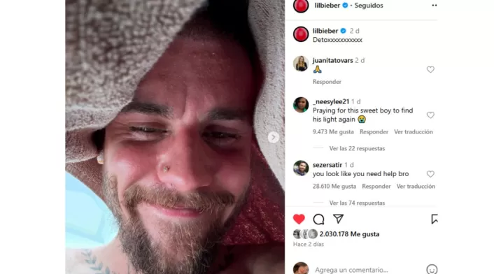 Justin Bieber subió algunas fotos de sus vacaciones donde preocupó a sus seguidores. Justin Bieber subió algunas fotos de sus vacaciones donde preocupó a sus seguidores.