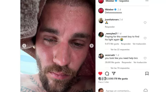 Justin Bieber preocupa a sus seguidores por fotos que muestran deterioro en su salud física y mental. Justin Bieber preocupa a sus seguidores por fotos que muestran deterioro en su salud física y mental.