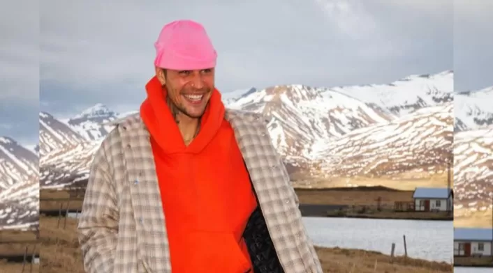 En junio de 2022, Justin Bieber anunció que había sido diagnosticado con el síndrome de Ramsay Hunt En junio de 2022, Justin Bieber anunció que había sido diagnosticado con el síndrome de Ramsay Hunt