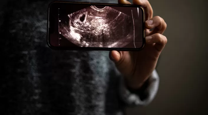 Imagen de referencia de un ecograma Una mujer sostiene en su teléfono la fotografía de un ecograma que muestra su embarazo.
