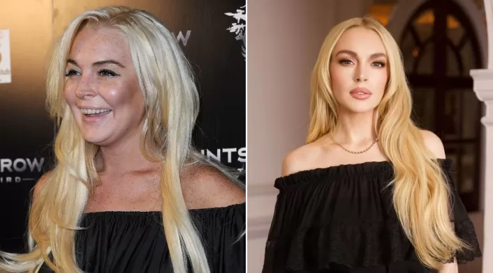 Lindsay Lohan habla sobre su rostro y explica los cambios que se evidencian en su apariencia Lindsay Lohan habla sobre su rostro y explica los cambios que se evidencian en su apariencia