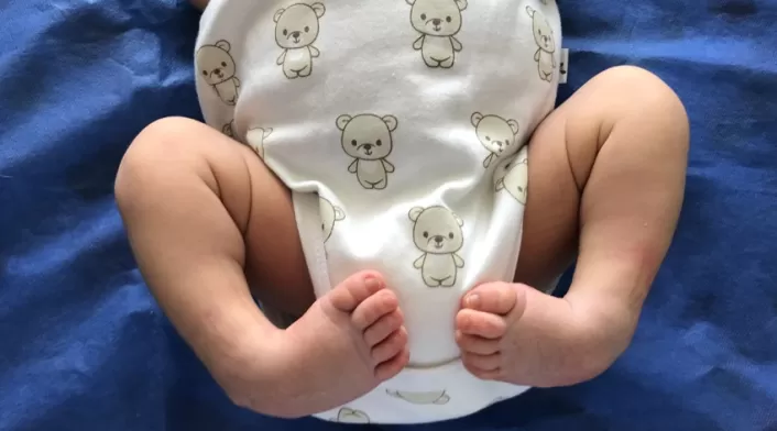 El tratamiento en los bebés. El tratamiento en los bebés.