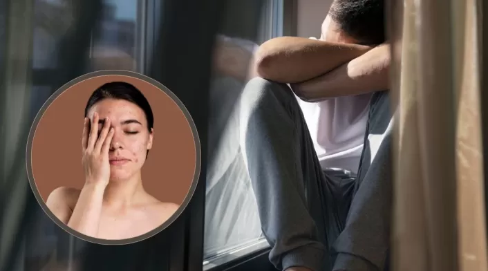 Salud mental y problemas cutáneos Salud mental y problemas cutáneos