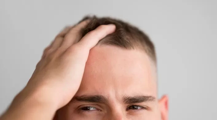 Alopecia Alopecia