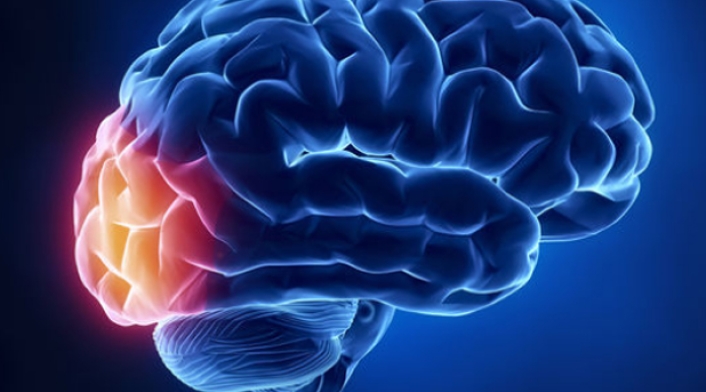 cerebroquiz1.jpg