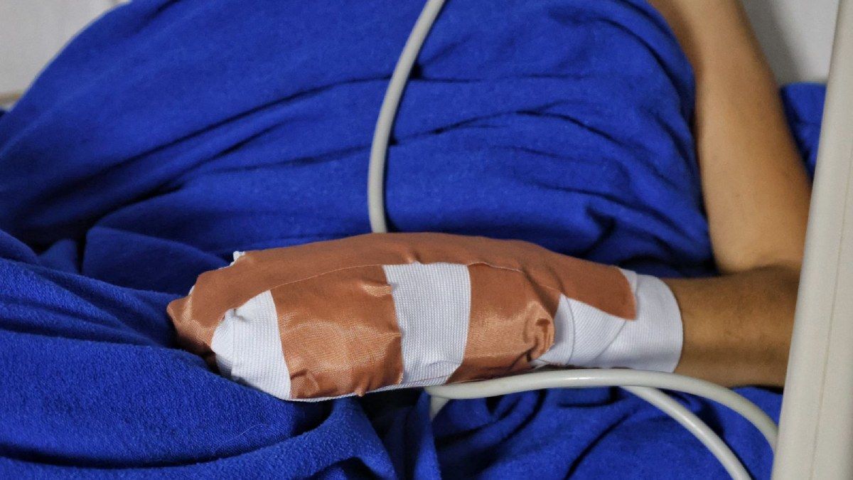 Quemados con pólvora