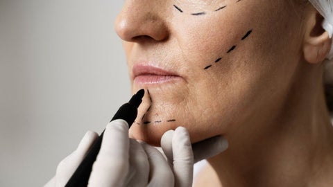 La intervención no correspondía a una cirugía formal, sino a un procedimiento para levantamiento de glúteos.