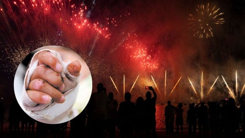 quemados-por-polvora-experto-responde-que-hacer-para-tratar-las-quemaduras-por-polvora-antes-de-acudir-a-un-centro-medico