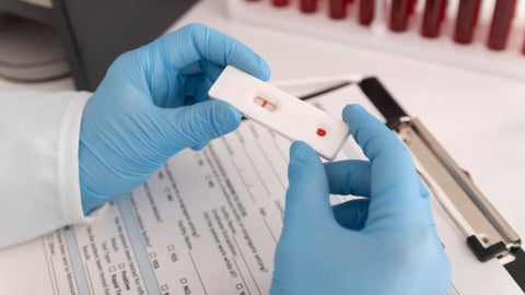 El reporte oficial indica que a la semana 45 del año en curso, han sido atendidos 515 casos positivos para esta enfermedad, la cual se transmite principalmente por vía sexual.