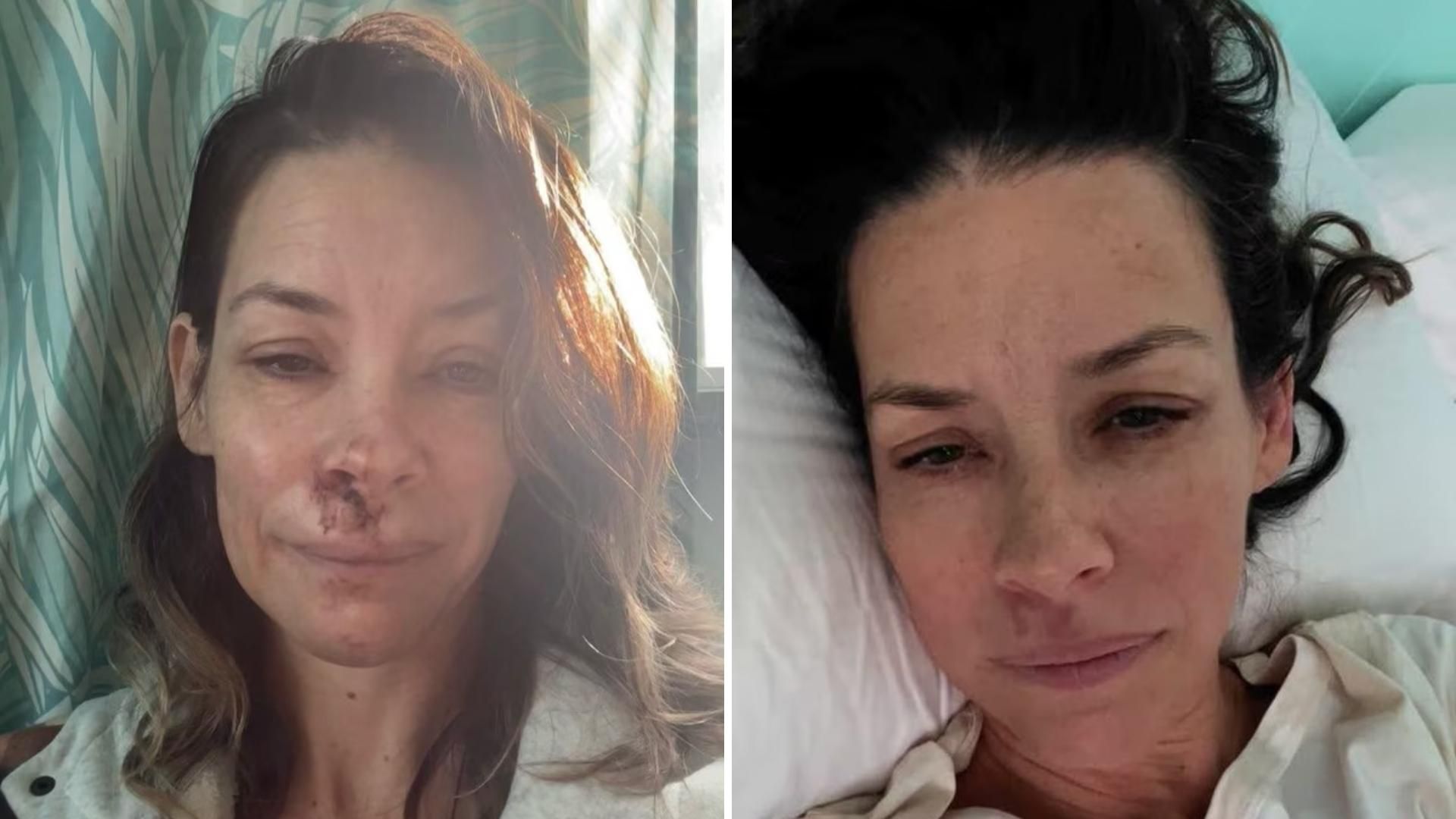 Evangeline Lilly confirmó que enfrenta daño cerebral tras un desmayo y una caída sufridos en Hawái en mayo de 2025.
