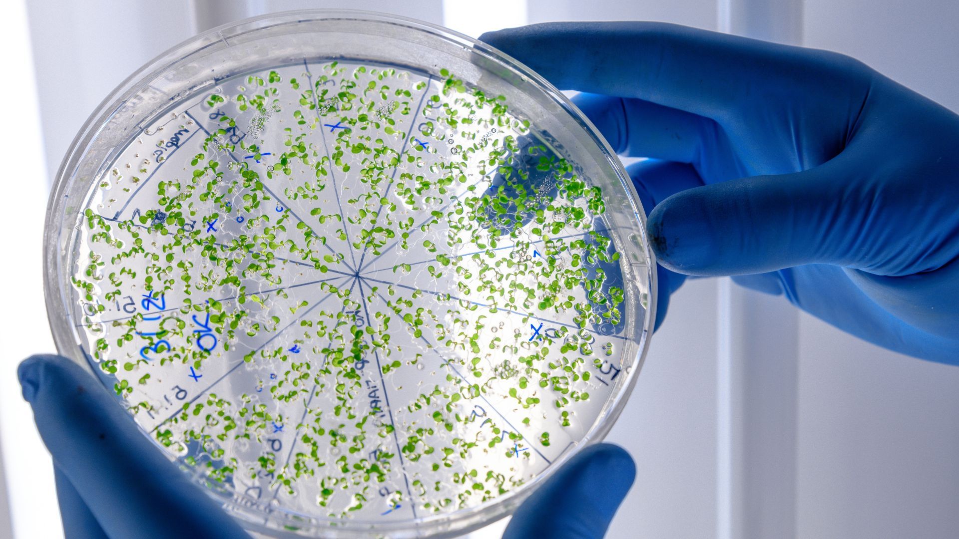 La listeriosis es una enfermedad asintomática, pero podría ayudar a la humanidad.