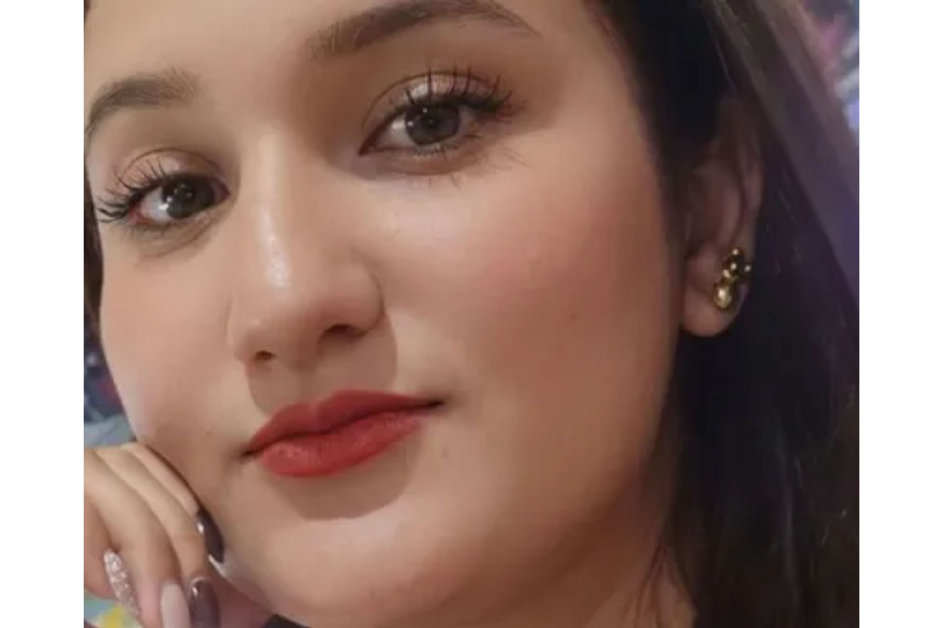 mujer que cayó de tobogán en Chinácota